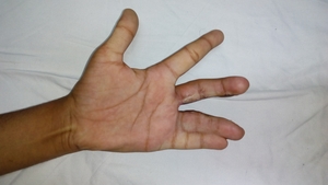 Shubhamkar hand clinic|Kothrud,Pune